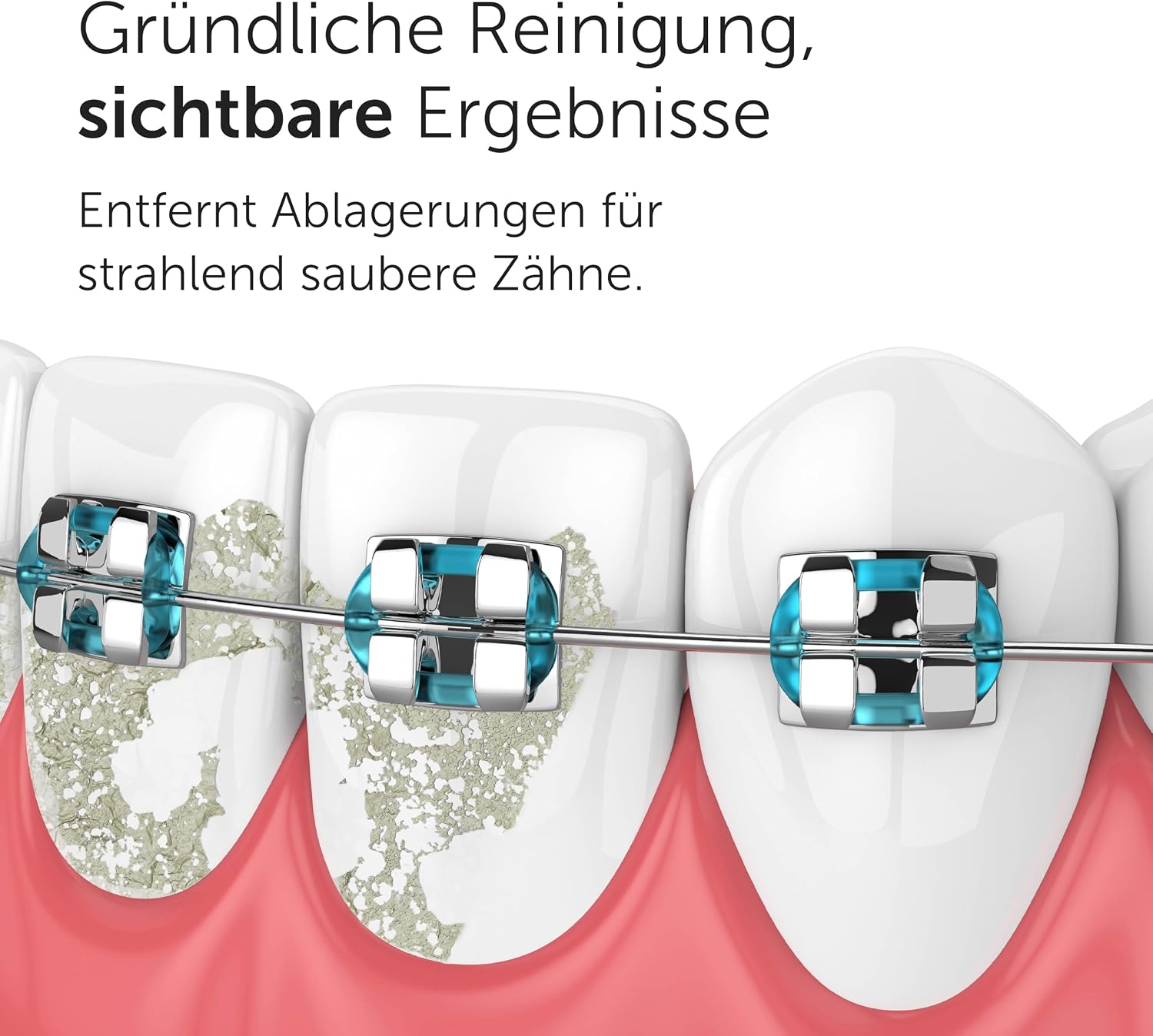 Detalle de Wondersmile Ersatzdüsen Munddusche Waterflow 4er Pack