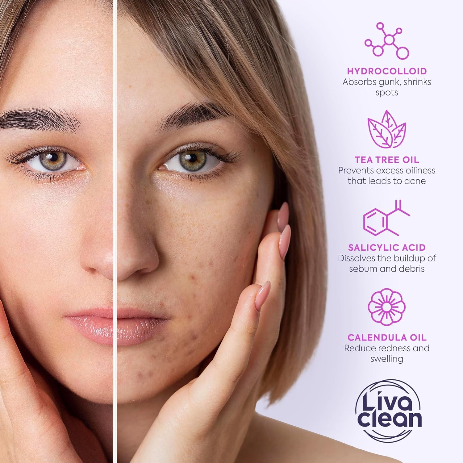 Thumbnail 5 de LivaClean 330 CT Pimple Patches ⚙