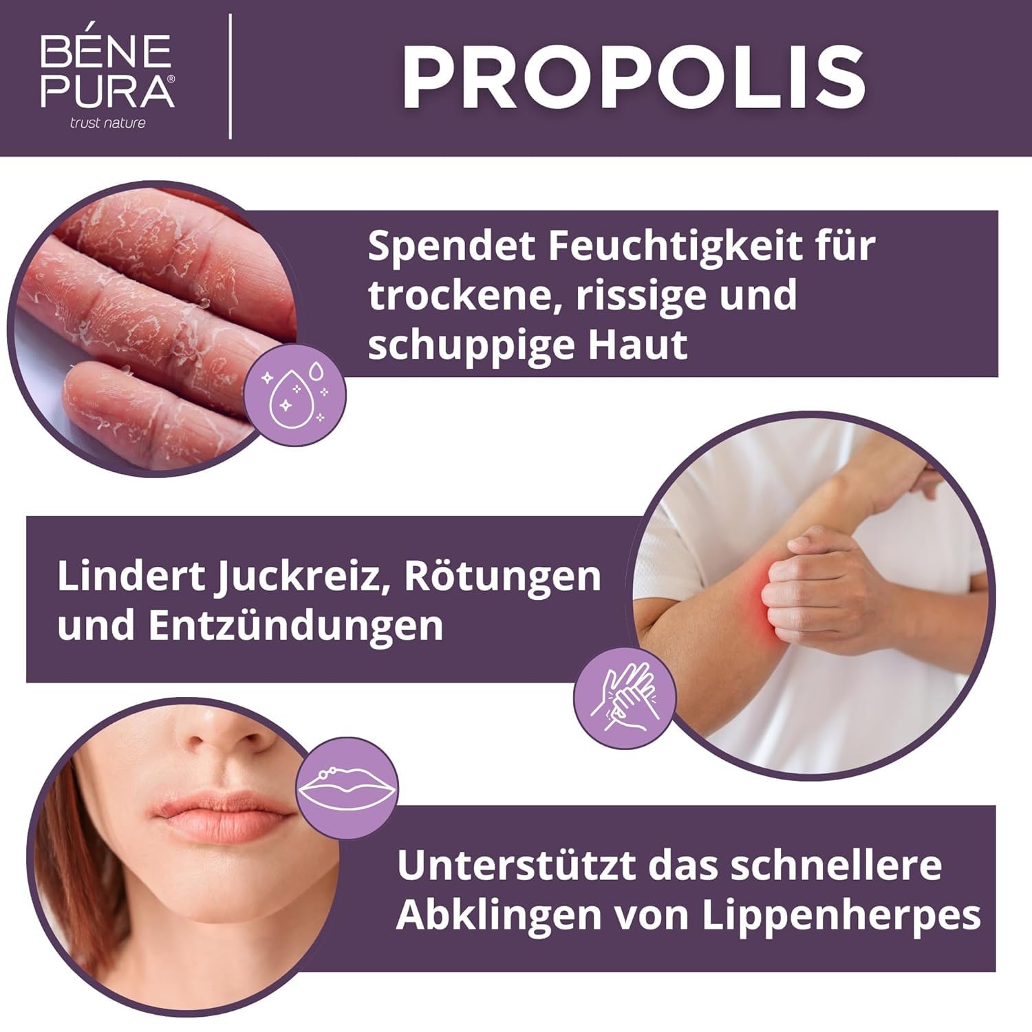 Detalle de Bene Pura Propolis Salbe 30% für trockene Haut 40 ml