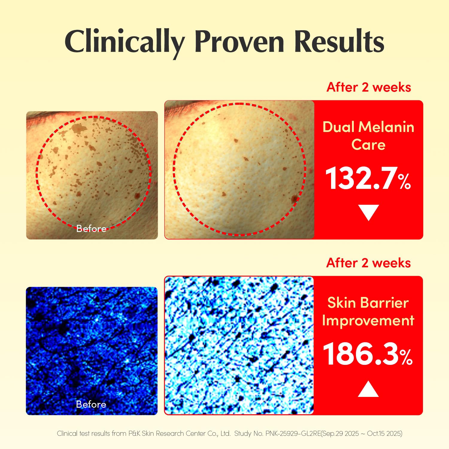 Thumbnail 4 de EQQUALBERRY Vitamin Illuminating Cream (Vitamin C, 5% Niacinamide, 3% TXA) for Dark Spots & Brightening