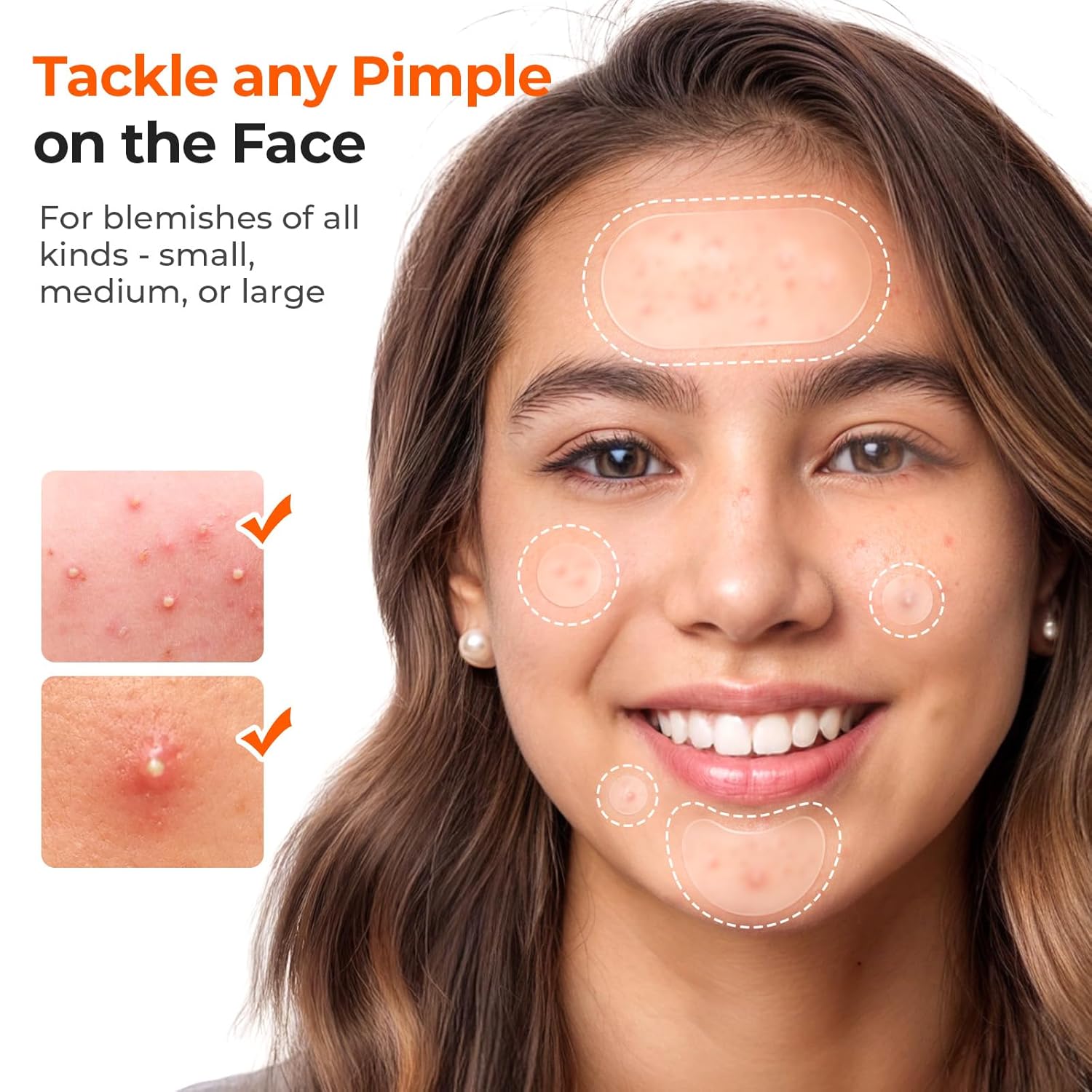 Thumbnail 2 de TKTK 443 Count Hydrocolloid Acne Patches for Face 🩹