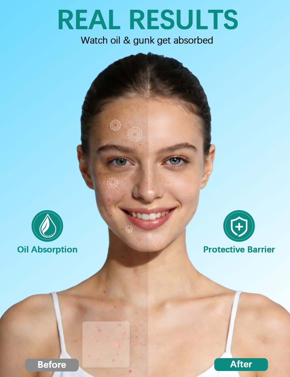 Detalle 2 de Patch Brufoli Pimple Patch XL for Face&Body: cerotti idrocolloidali per ampie zone (524) con tea tree