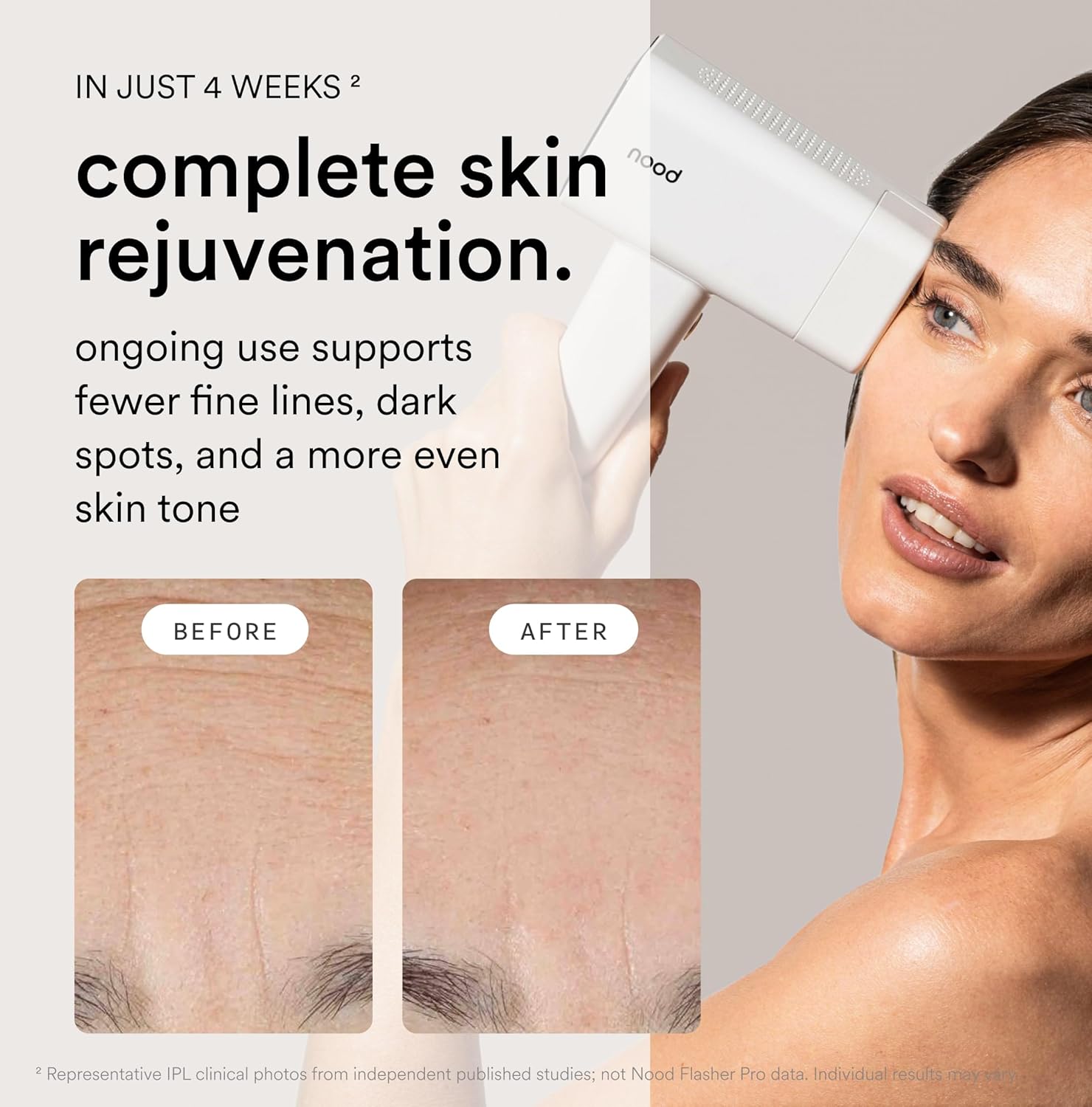 Detalle de Nood NEW Flasher Pro IPL hair removal