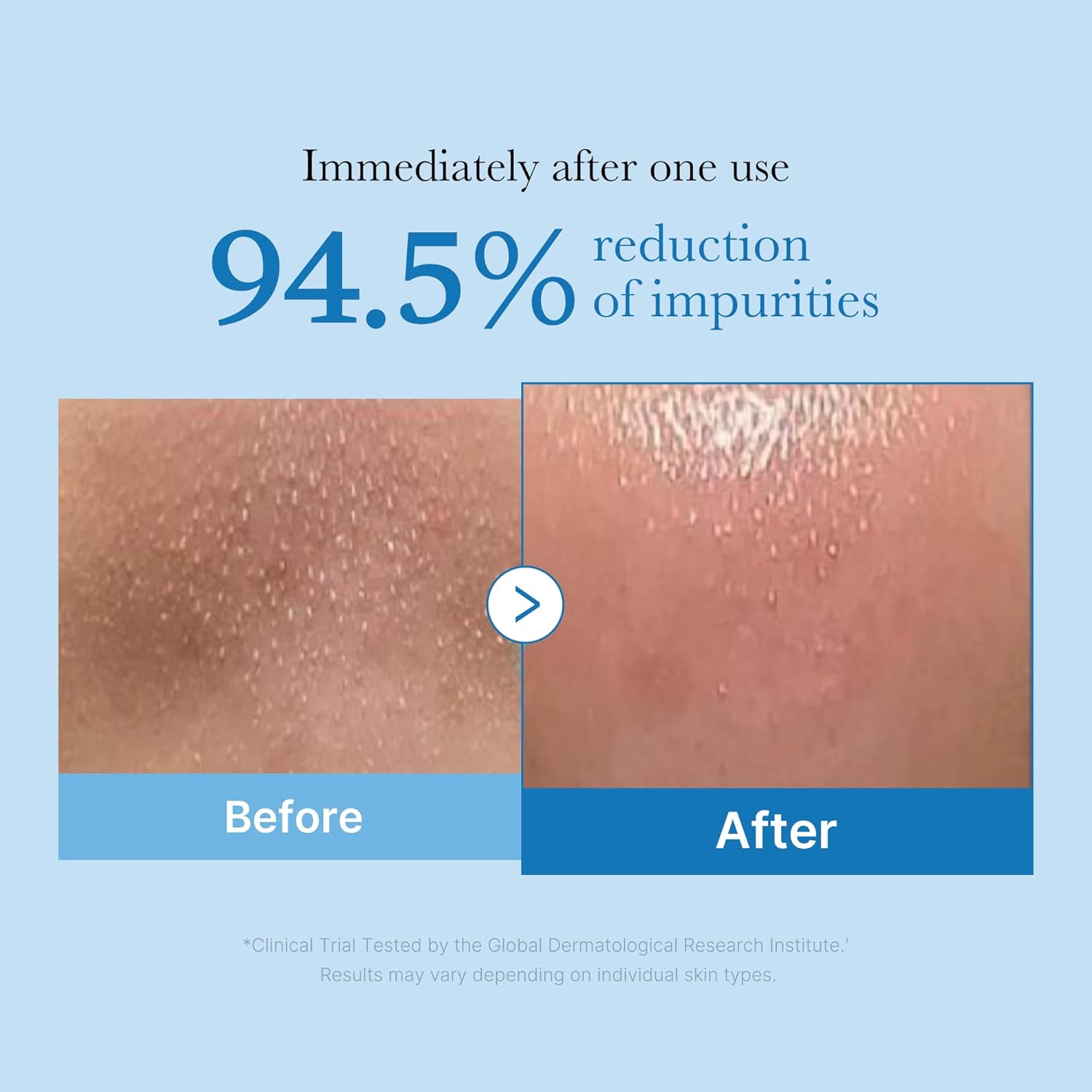 Detalle 2 de medicube Zero Pore Blackhead Cleansing Oil 205 ml