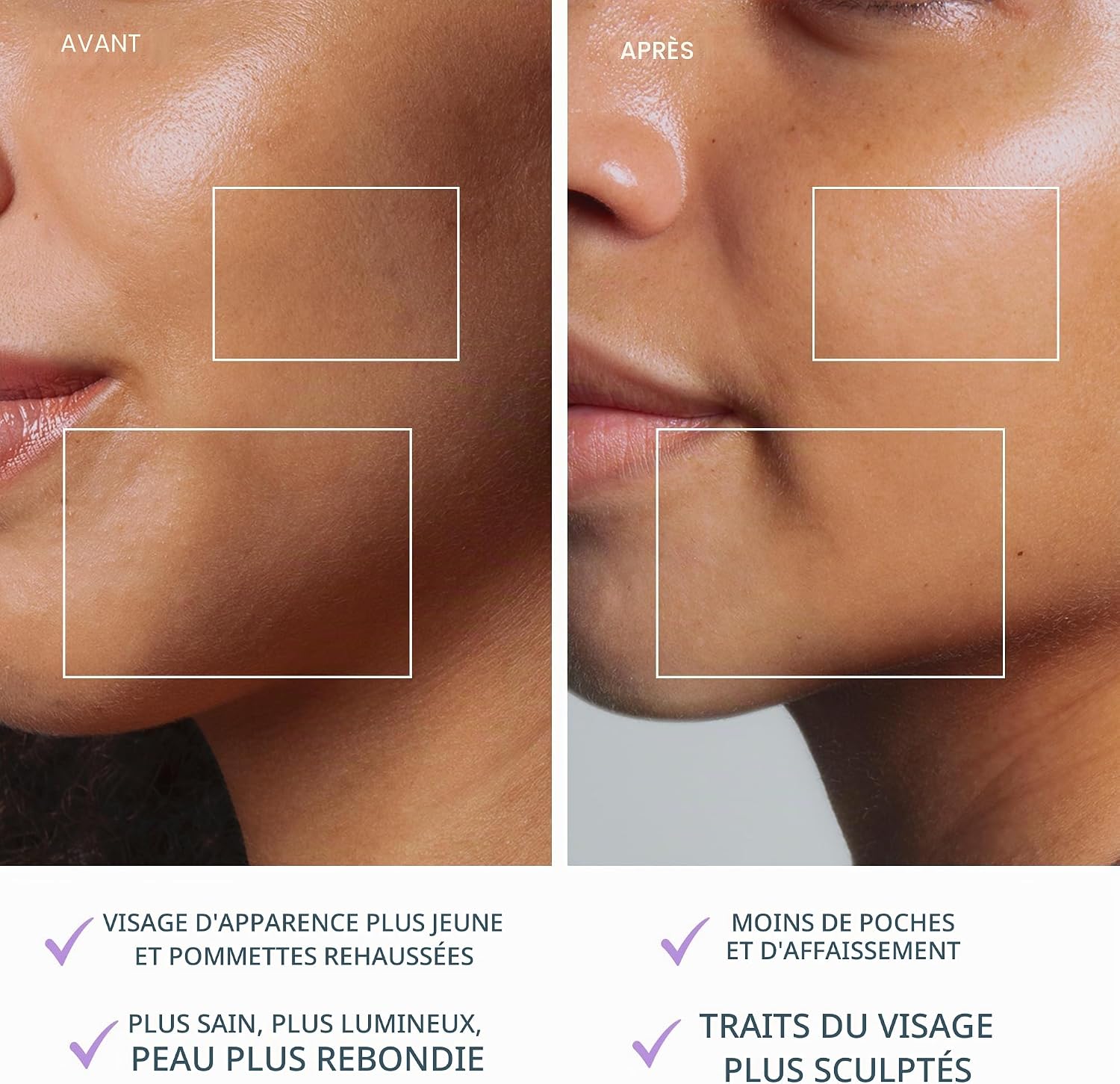 Thumbnail 4 de FOREO BEAR 2 go — appareil micro courants visage liftant et tonifiant de voyage