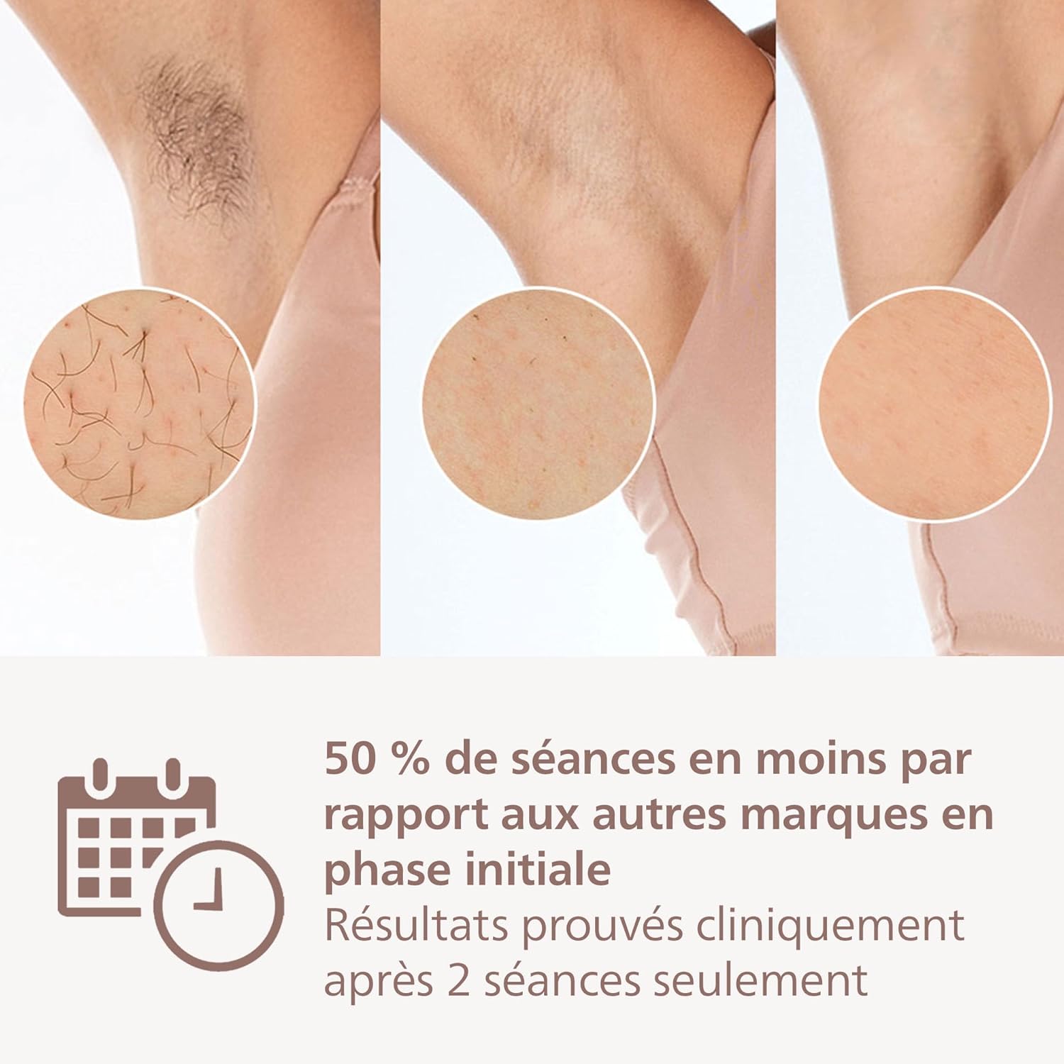 Detalle 1 de Philips Lumea série 9000, épilateur à lumière pulsée, 4 accessoires ⚙
