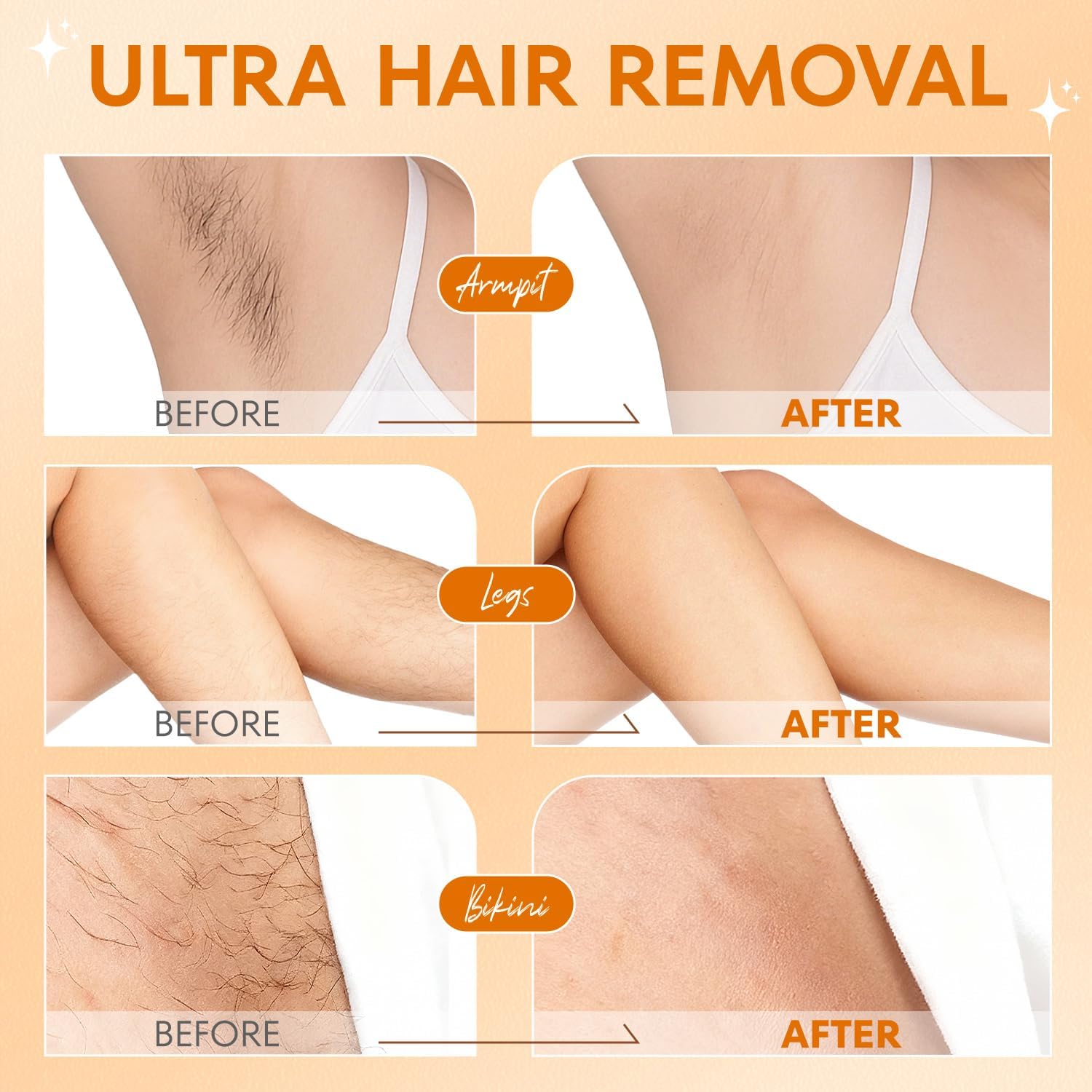 Detalle 2 de VG VOGCREST Bikini Trimmer für Frauen (2-in-1) – schmerzloses Trimmen & Rasieren, IPX7, Champagner Gold