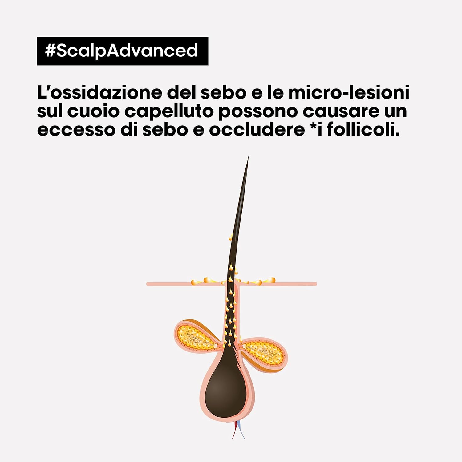 Thumbnail 1 de L'Oréal Professionnel Paris Shampoo Lenitivo Scalp Advanced al 3% AHA per cuoio capelluto grasso, effetto rinfrescante (500 ml)