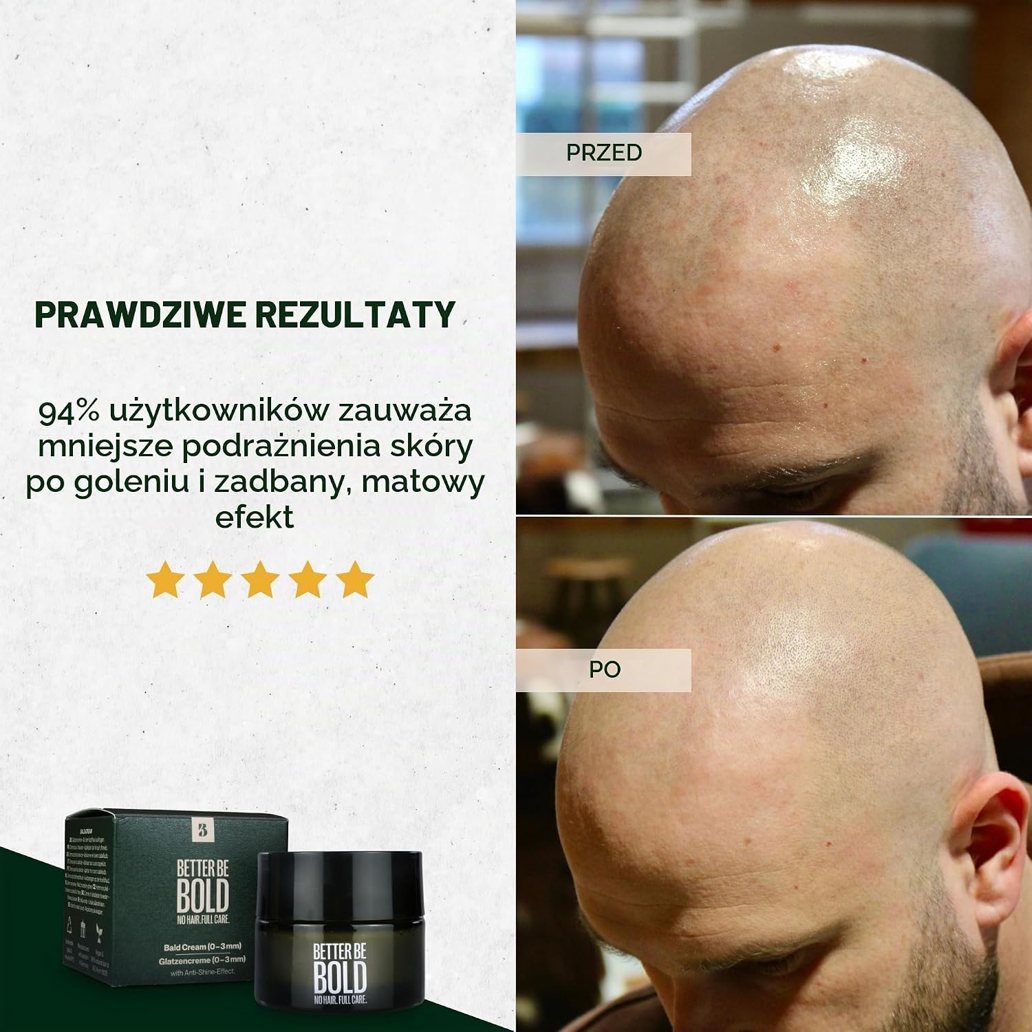 Detalle de BETTER BE BOLD krem do skóry głowy po goleniu, 50 ml, do 0–3 mm