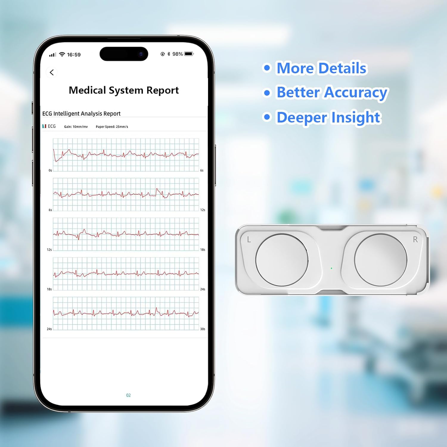 Detalle de ECG Monitor Portable ECG Monitor for Home Use