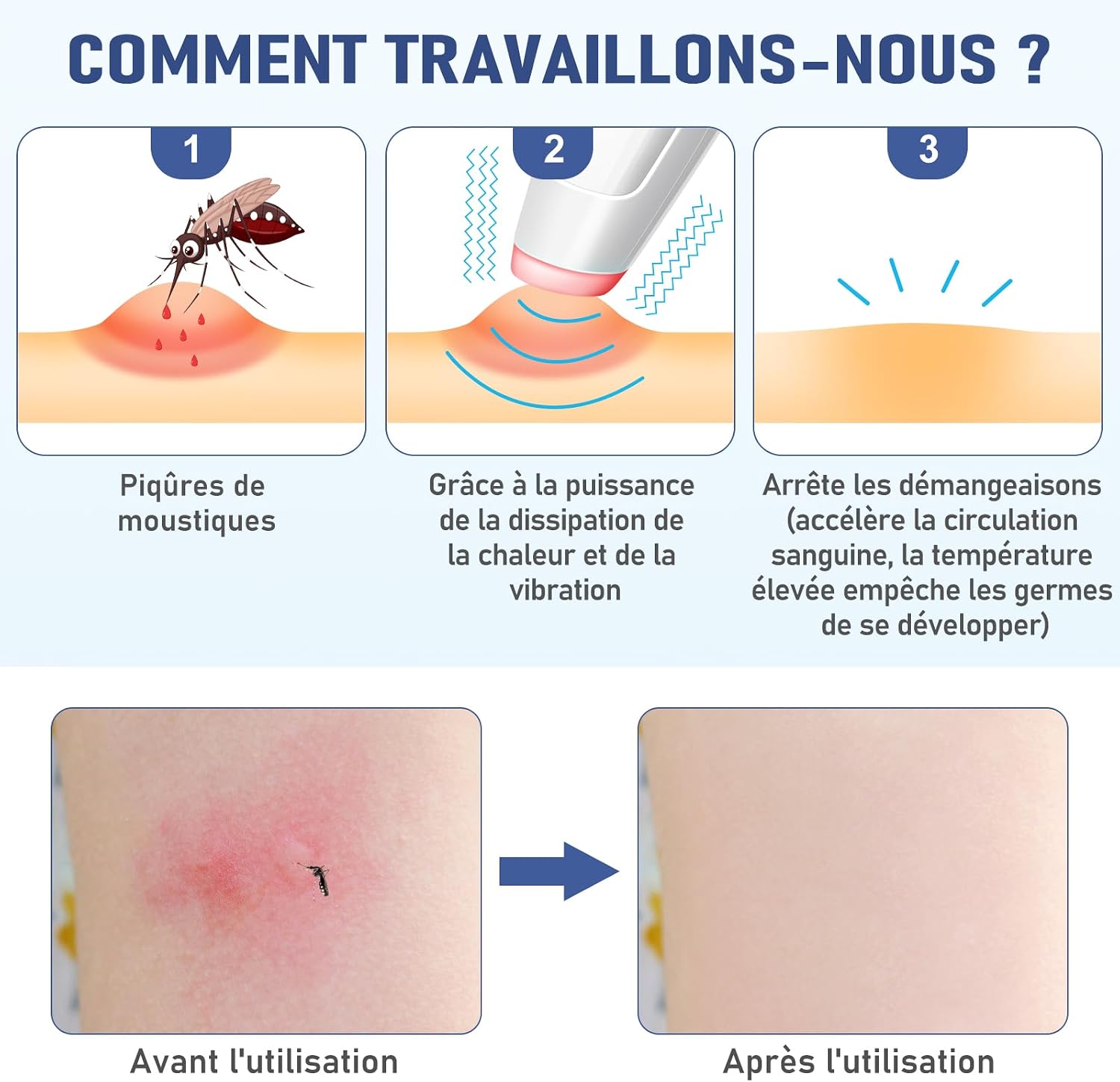 Detalle de ICARe Stylo chauffant anti-piqûres d'insectes – rechargeable, 4 niveaux de chaleur