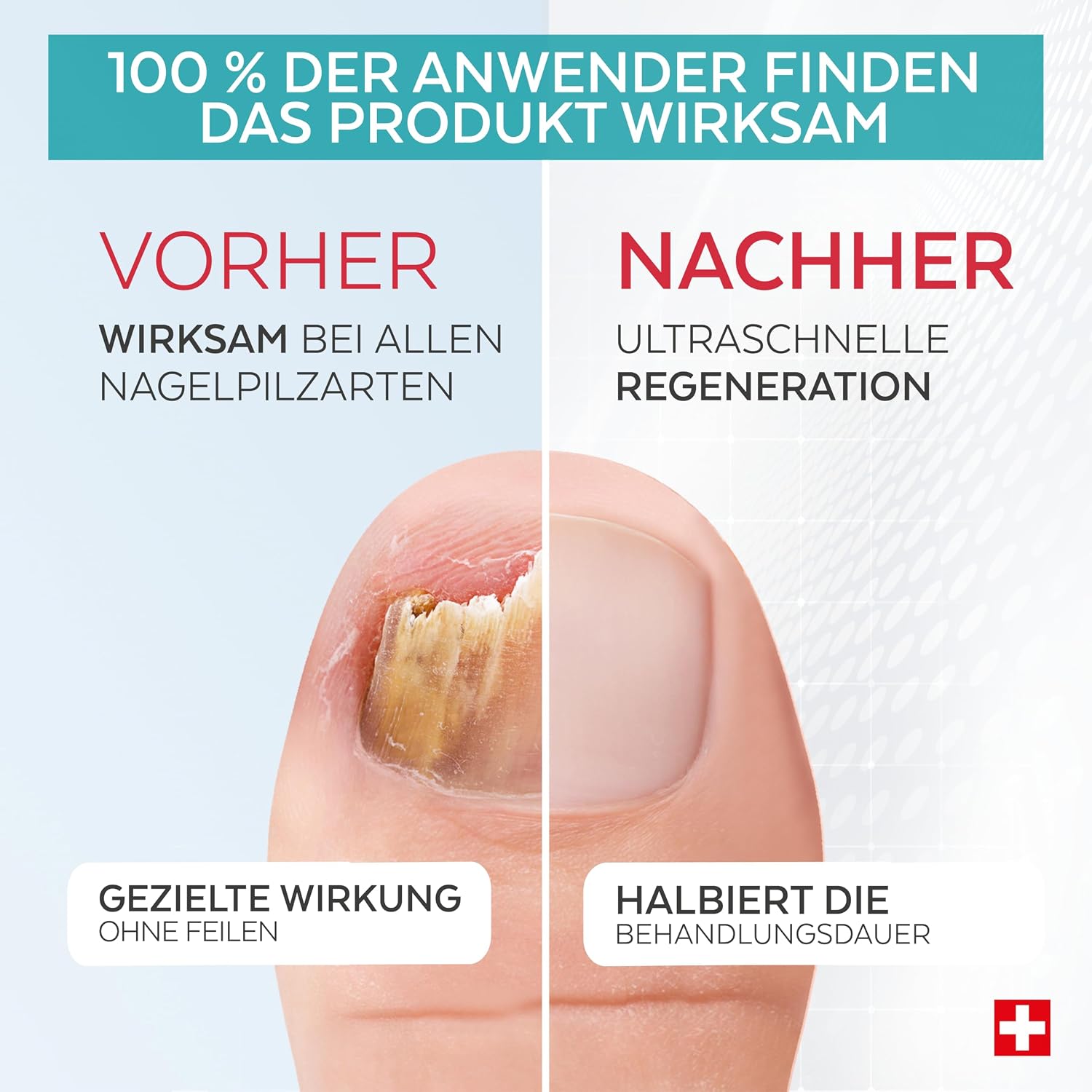 Detalle de PODERM Nagelpilz 2 Stück