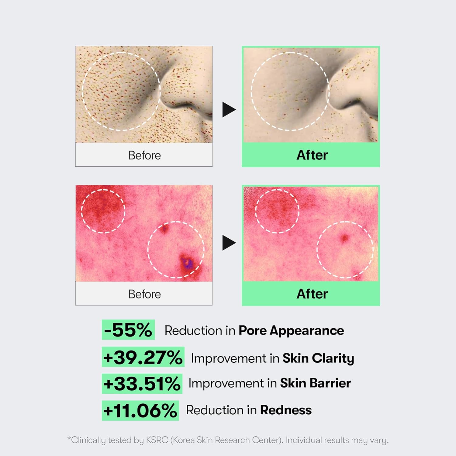 Detalle 2 de VT COSMETICS CICA Reedle Shot 100 spicule microneedling serum (50ml) for pore care & texture