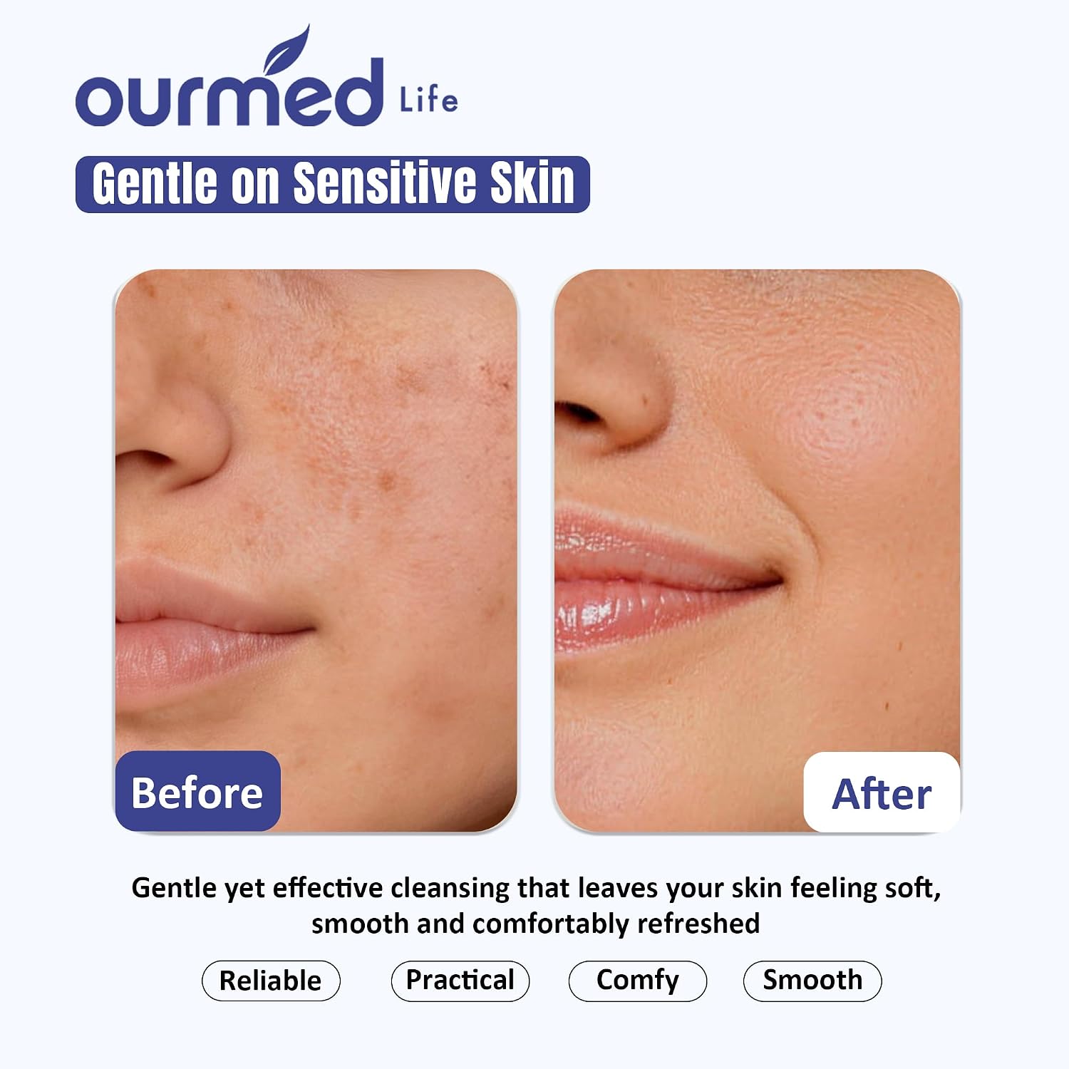 Detalle de Ourmed Life Face Clean Towels salviette viso biodegradabili senza profumo (100 pz) per pelli sensibili