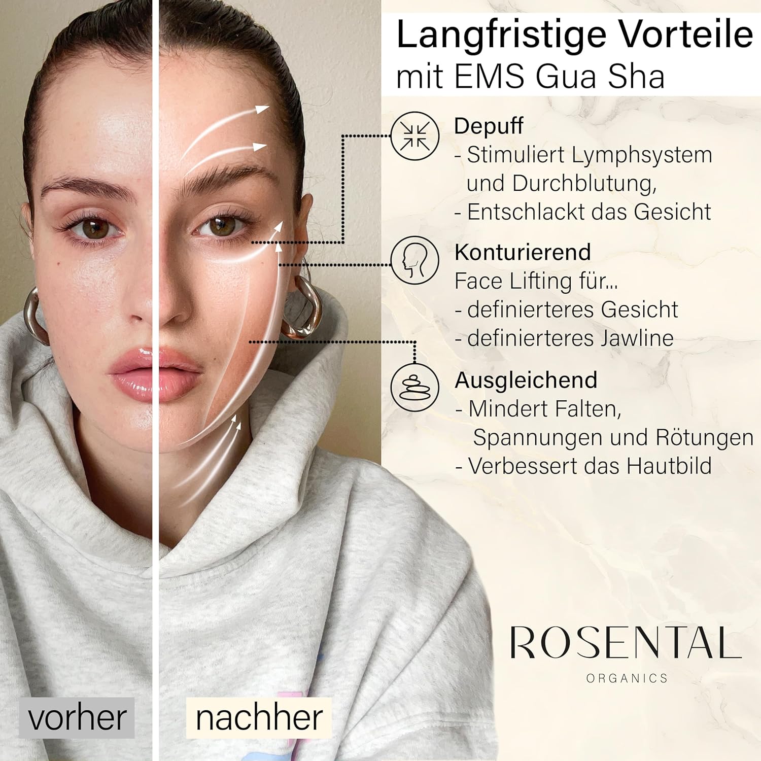 Thumbnail 3 de Rosental Organics EMS Gua Sha Gesichtsmassagegerät