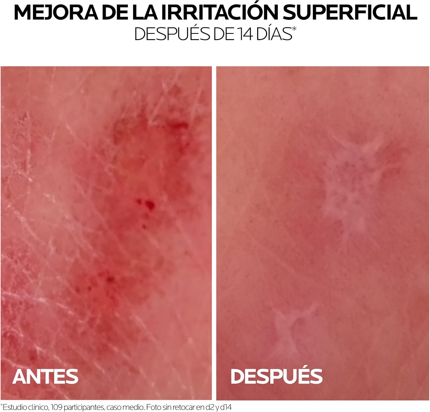 Thumbnail 5 de La Roche-Posay Cicaplast Baume B5 con centella: bálsamo calmante y reparador para pieles sensibles