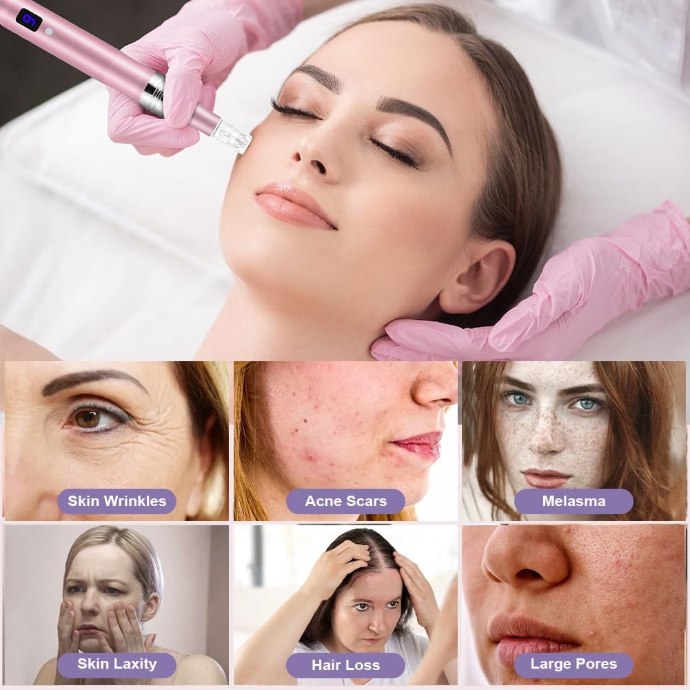 Detalle 2 de Vicloon Dermapen Microneedling 0-2,5 mm