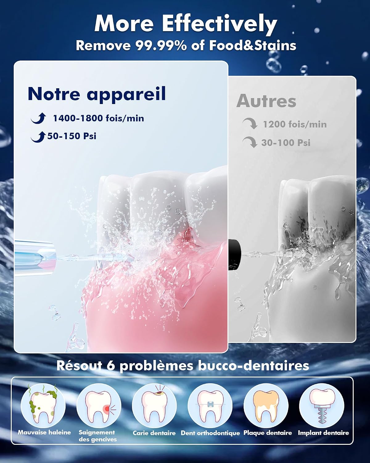 Thumbnail 2 de Jet Dentaire Hydropulseur 300ML