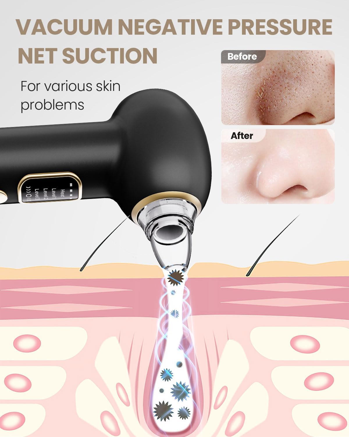 Thumbnail 3 de Heated Blackhead Remover with 5 Probes