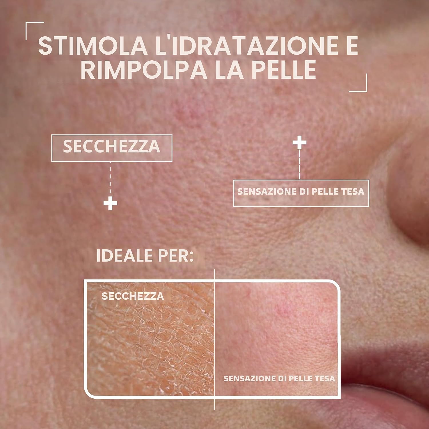 Detalle de Mixa Siero concentrato reidratante per pelli disidratate e sensibili – 30 ml