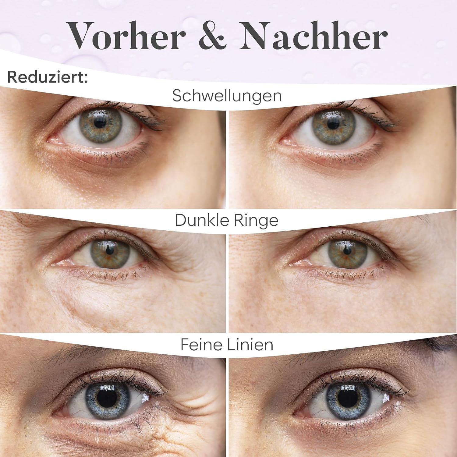 Detalle de BLOOMORA Retinol & Collagen Augenpads (30 Paare) – Eye Pads mit Niacinamid & Hyaluron