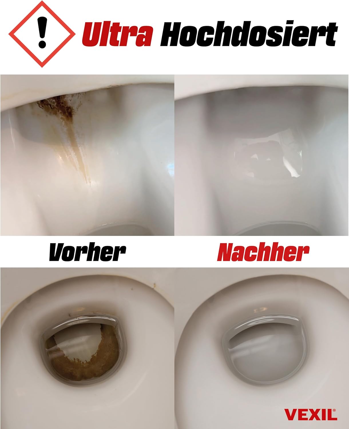 Thumbnail 3 de VEXIL Urinsteinentferner EXTRA STARK 1000 ml