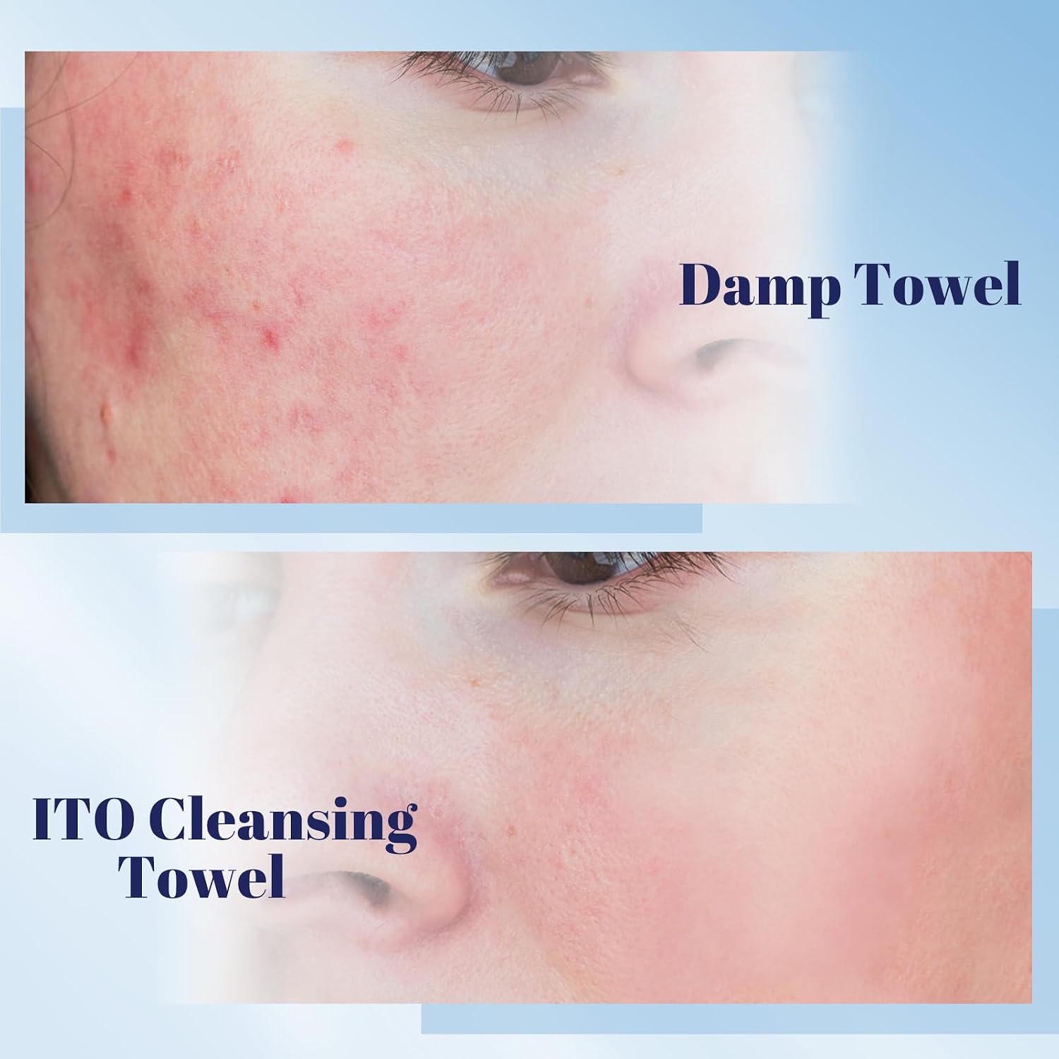 Thumbnail 5 de ITO Disposable Face Towel 180 Count