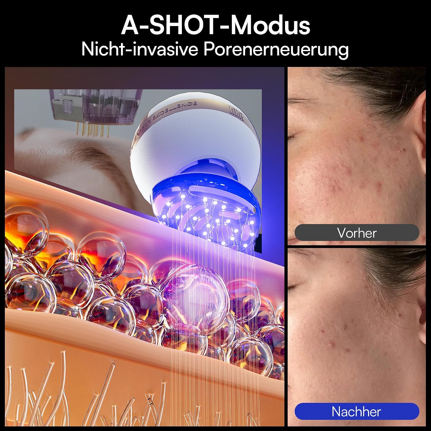 Thumbnail 6 de INIA SPHERA Verbesserter 8-in-1 Mikrostrom-Gesichtsmassager mit Rotlicht, Wärme- & Kühlfunktion