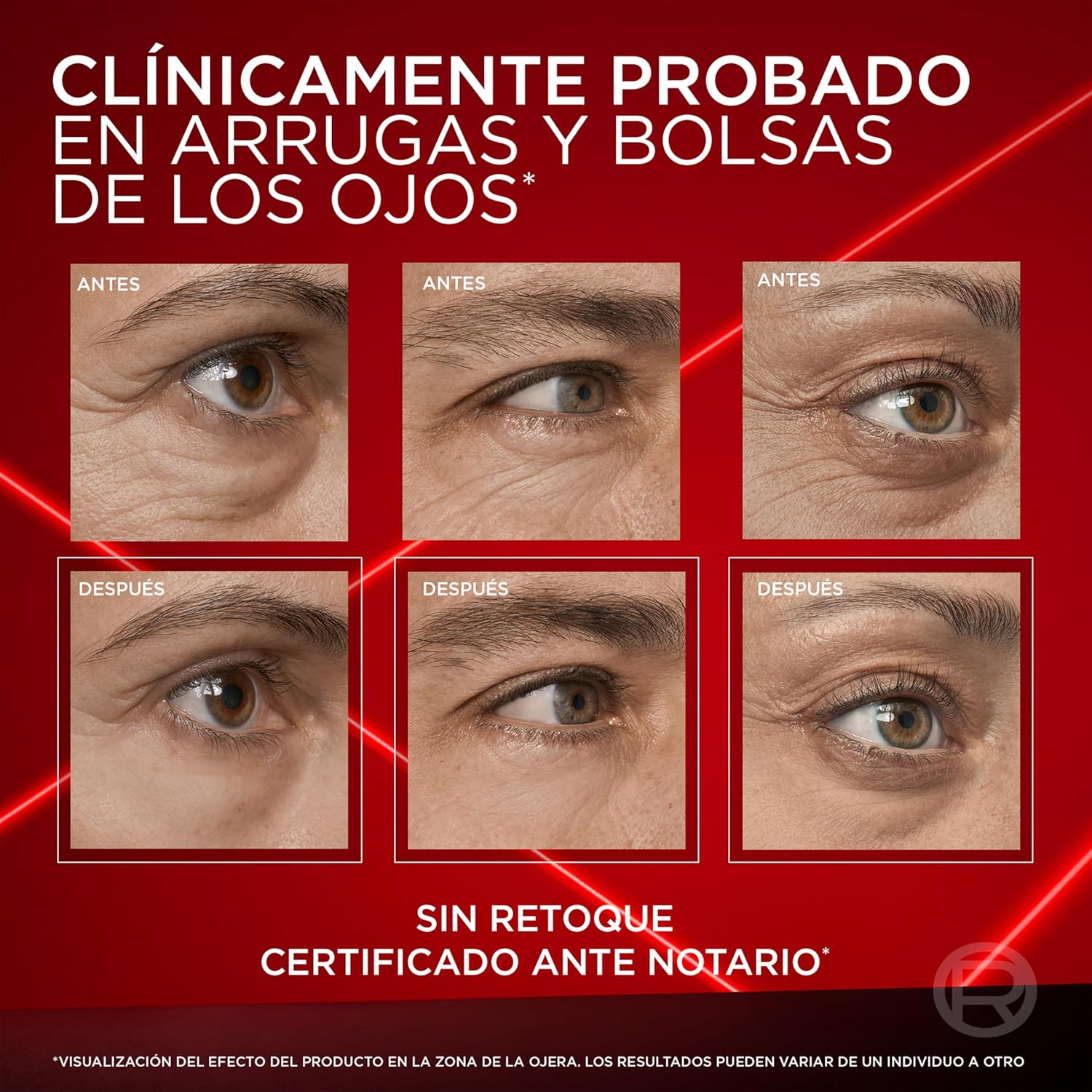 Thumbnail 5 de L'Oréal Paris Revitalift Laser Borrador de Bolsas Instantáneo. Deshincha y Alisa Bolsa de los Ojos en 15 minutos*. Corrector de Ojos. Mirada Firme y Rejuvenecida. Contorno de Ojos Hombre y Mujer.15ml