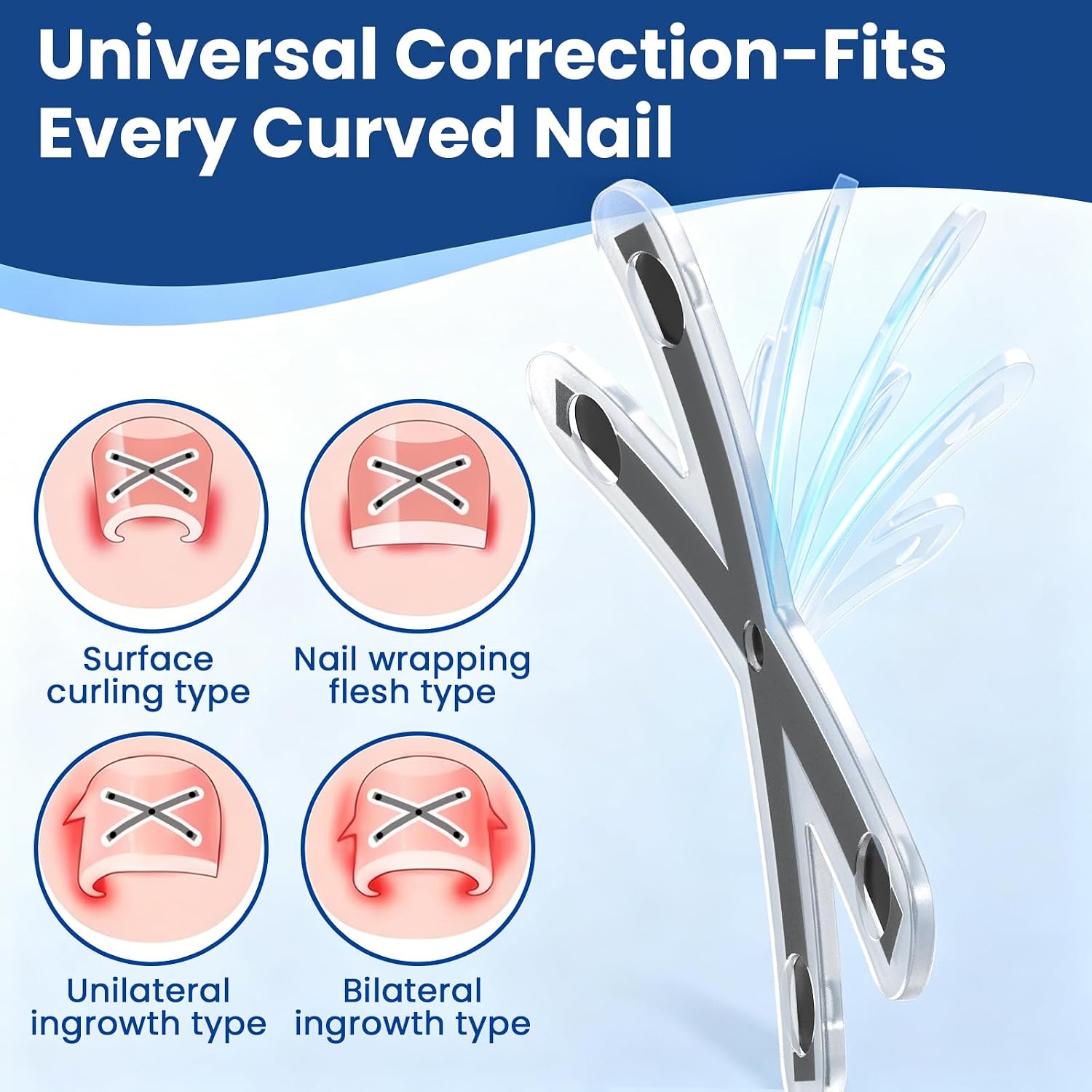 Thumbnail 1 de Ingrown Toenail Corrector, Titanium Alloy