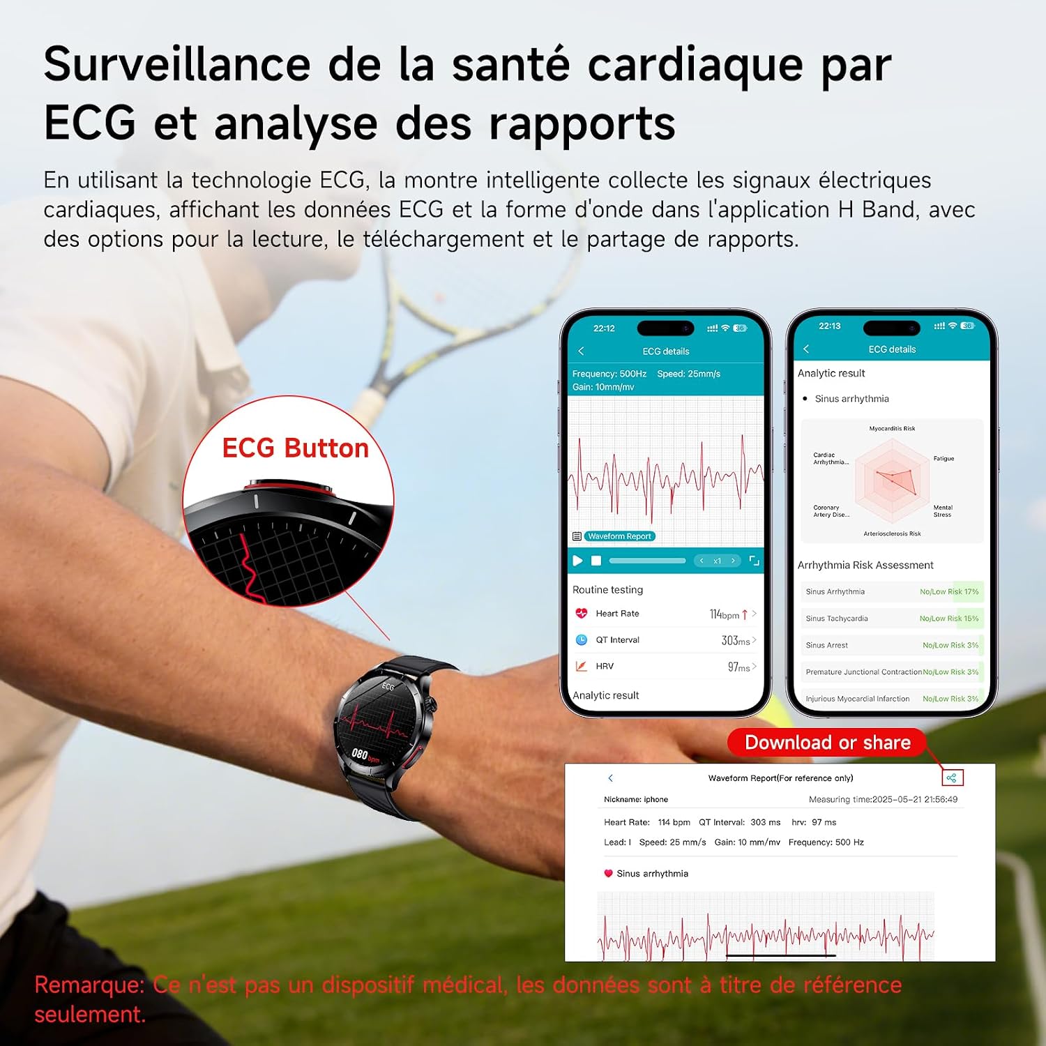 Detalle de YUPENG 2026 Nouvelle Montre Connectée Homme — ECG/HRV, Tension, BMI et 120 modes sportifs