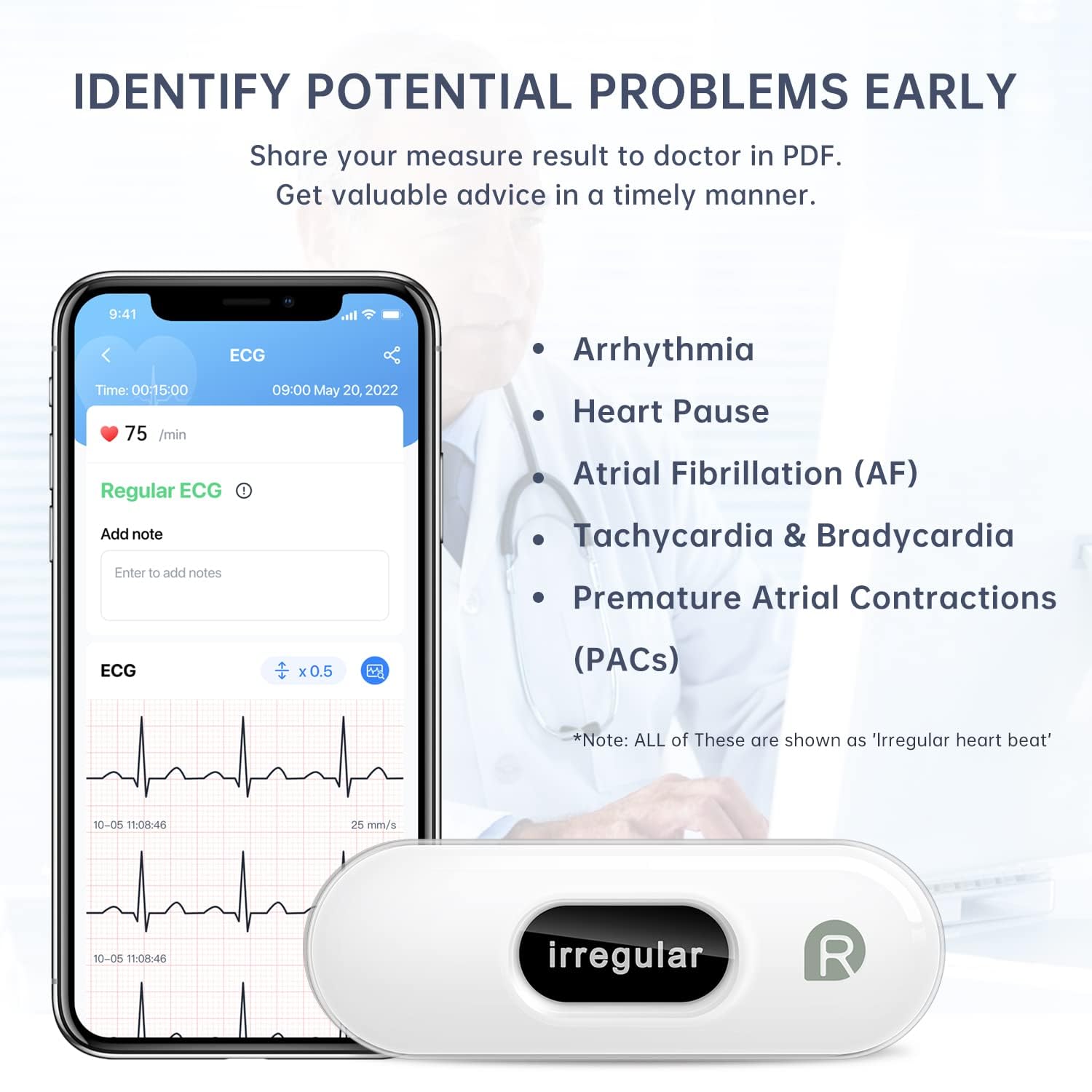 Detalle de CheckMe DuoEK-S home ECG monitor with Bluetooth and OLED screen