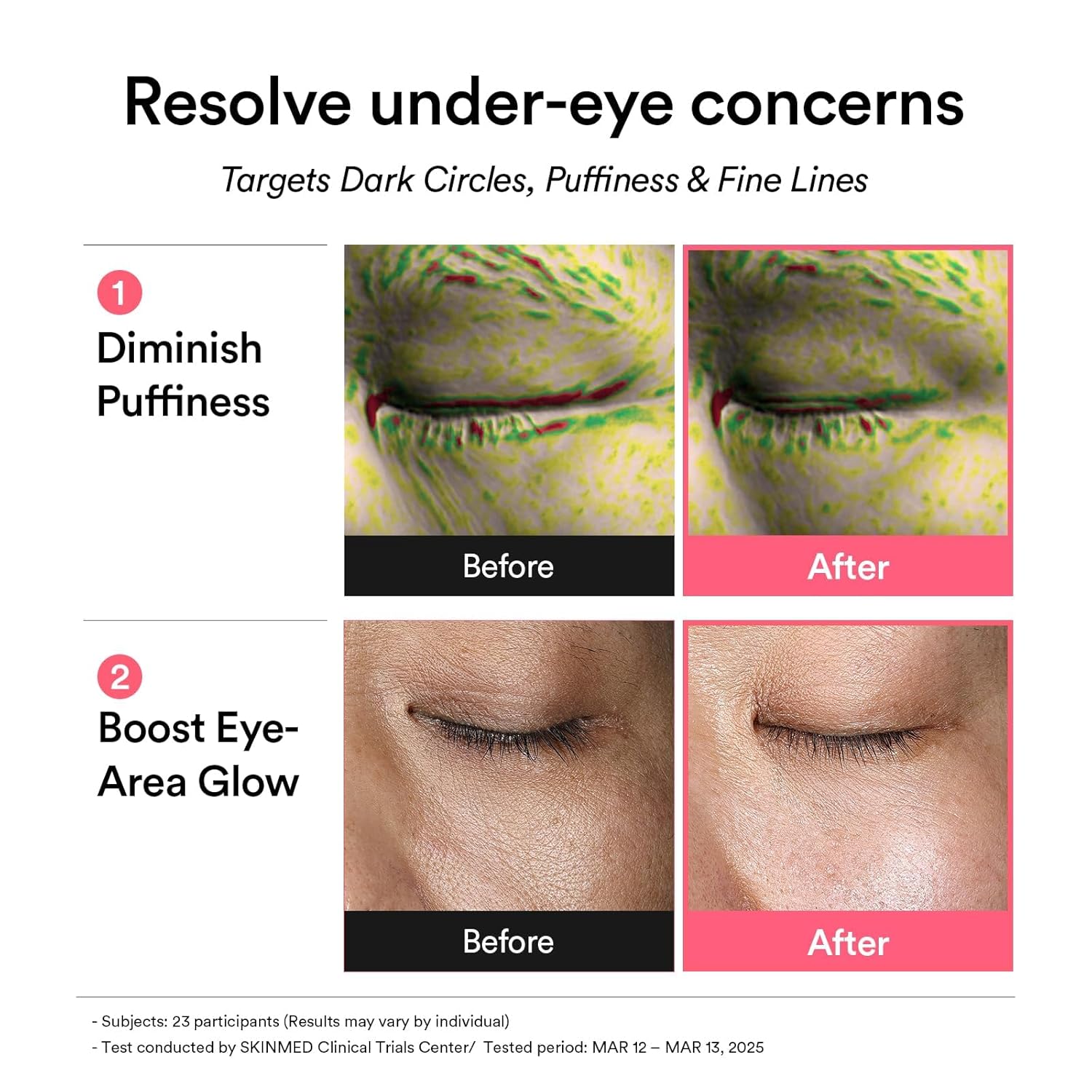 Thumbnail 3 de Abib PDRN Retinal Eye Patches with Glow Jelly: Rejuvenation for Puffy Eyes
