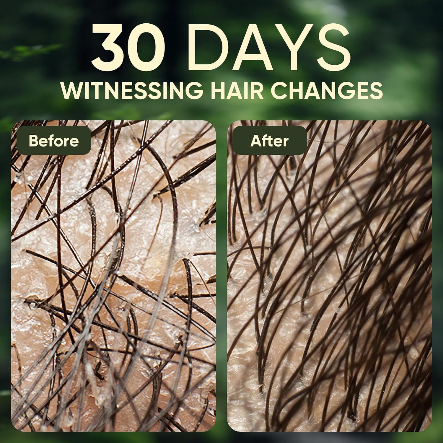 Thumbnail 6 de Agodafoo Batana Oil Shampoo with Rosemary Oil, 10.58 fl oz