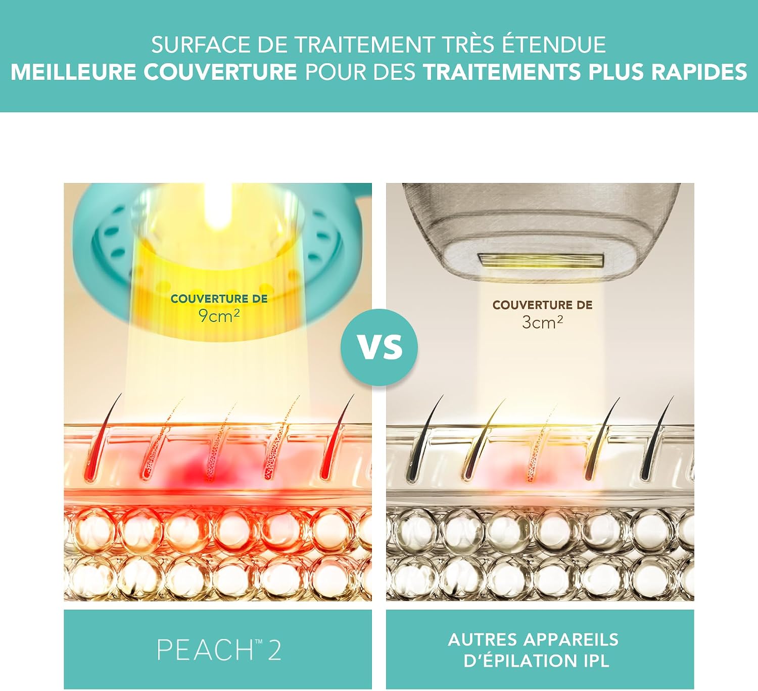 Thumbnail 2 de FOREO Peach 2 IPL – Épilateur lumière pulsée pour corps et visage