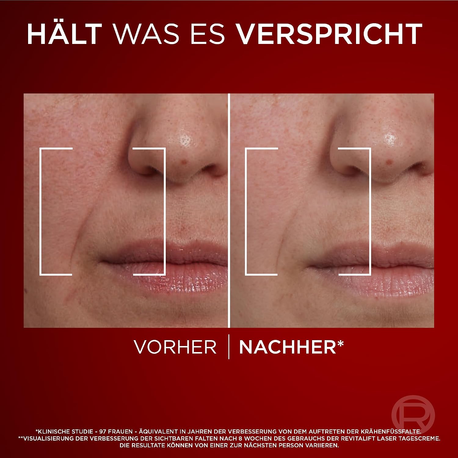 Thumbnail 4 de L'Oréal Paris Revitalift Laser Gesichtspflegeset 2×50 ml