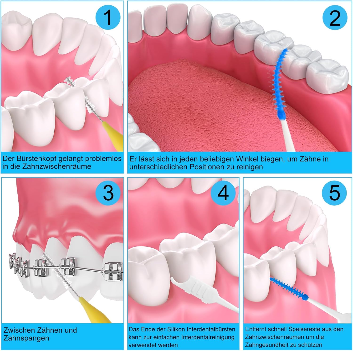 Thumbnail 4 de jjshund Interdentalbürsten Set 255 Stück