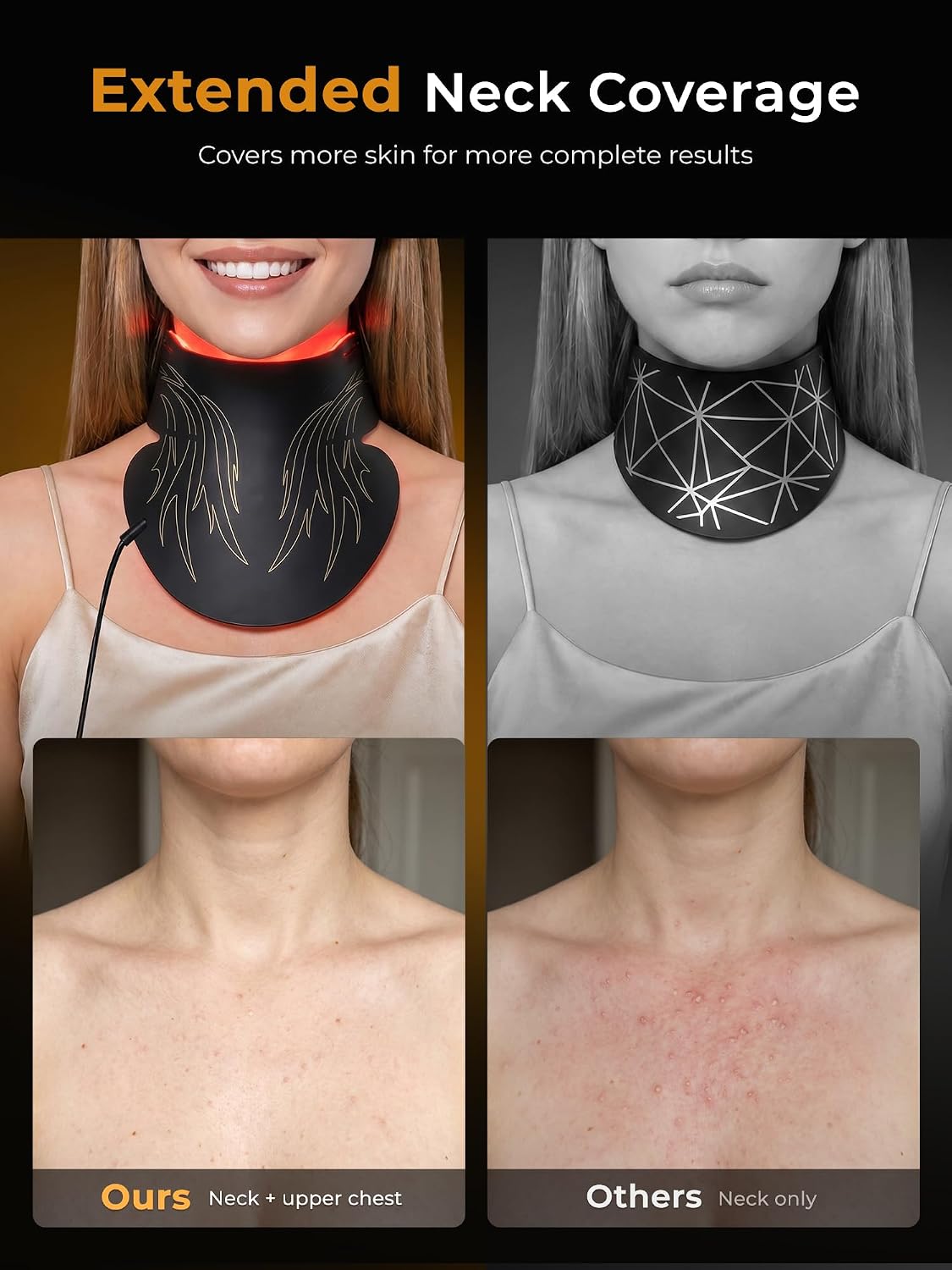 Detalle de Qynera LED face mask M09