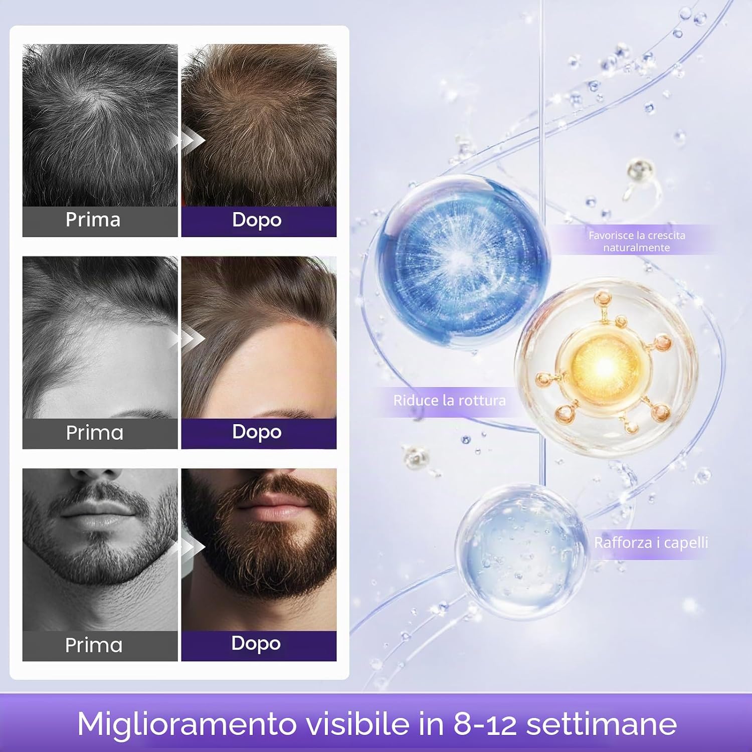 Detalle 2 de Siero Crescita Capelli con Olio di Ricino, Batana e Rosmarino – 60 ml