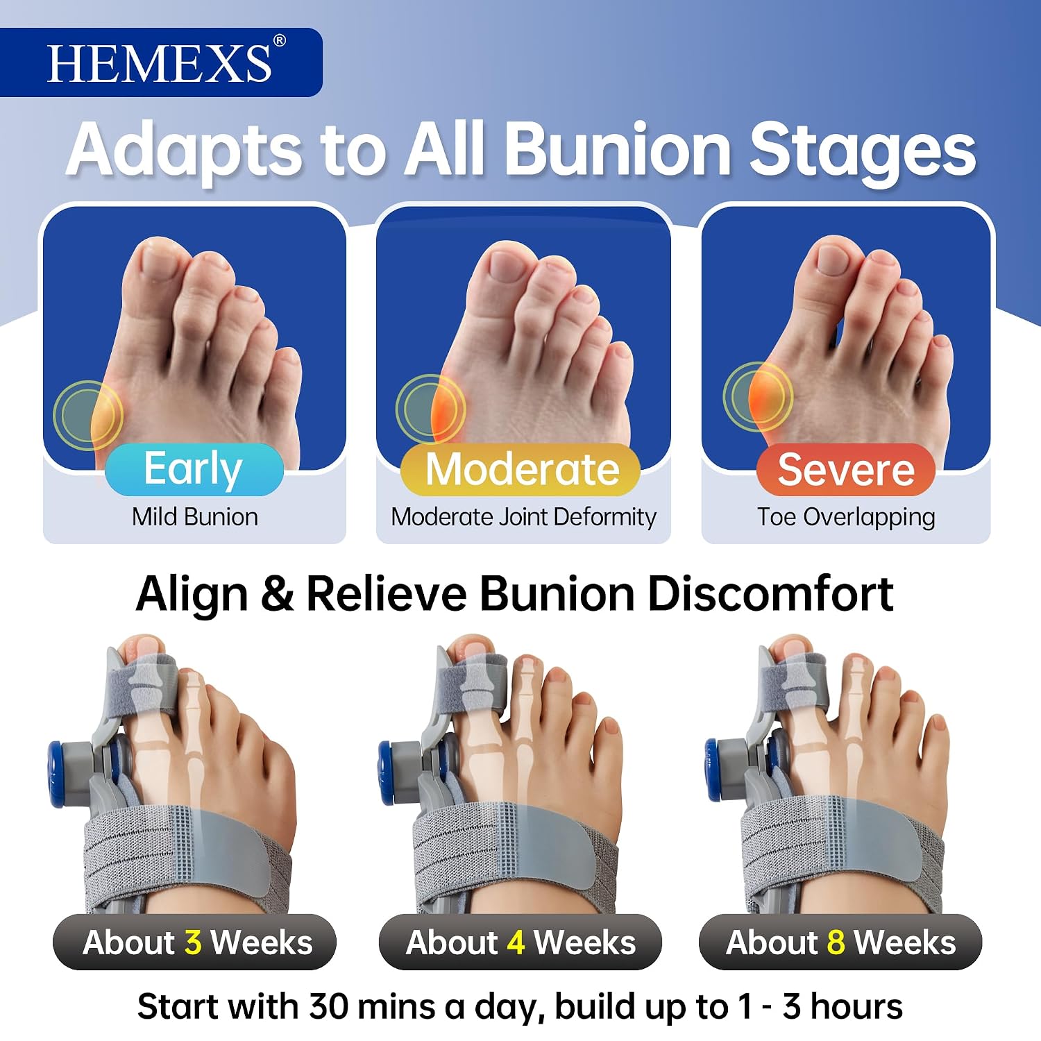 Thumbnail 3 de Bunion corrector with adjustable knob