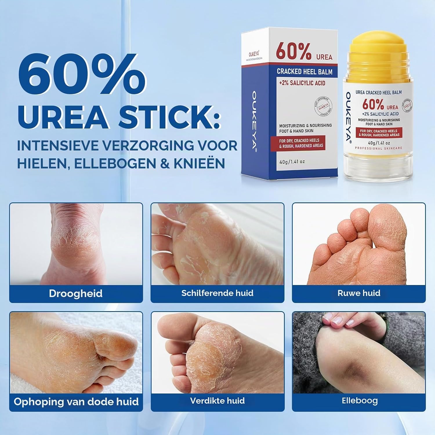 Thumbnail 2 de OUKEYA Eeltverwijderstick met 60% ureum en 2% salicylzuur, 40 g
