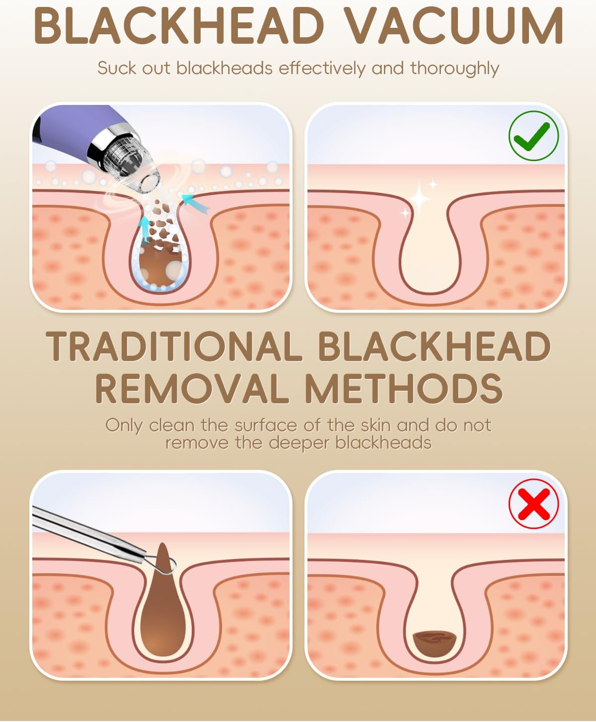 Thumbnail 3 de Pore Vacuum Blackhead Remover - Pore Extractor with 5 Attachments & 3 Suction Levels (Purple)