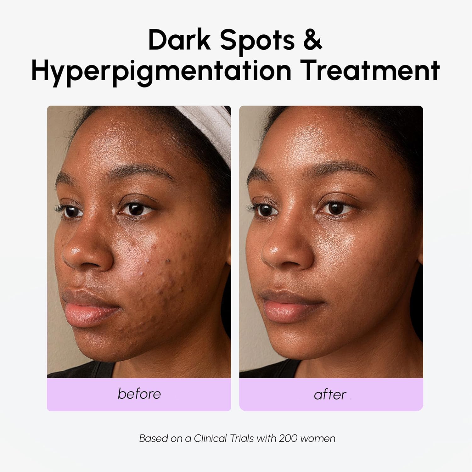 Thumbnail 5 de MAREE 20% Tranexamic Acid Serum for Dark Spots