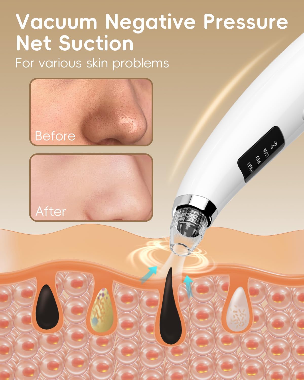 Detalle de Pore Vacuum Blackhead Remover - Pore Extractor with 5 Attachments & 3 Suction Levels (White)