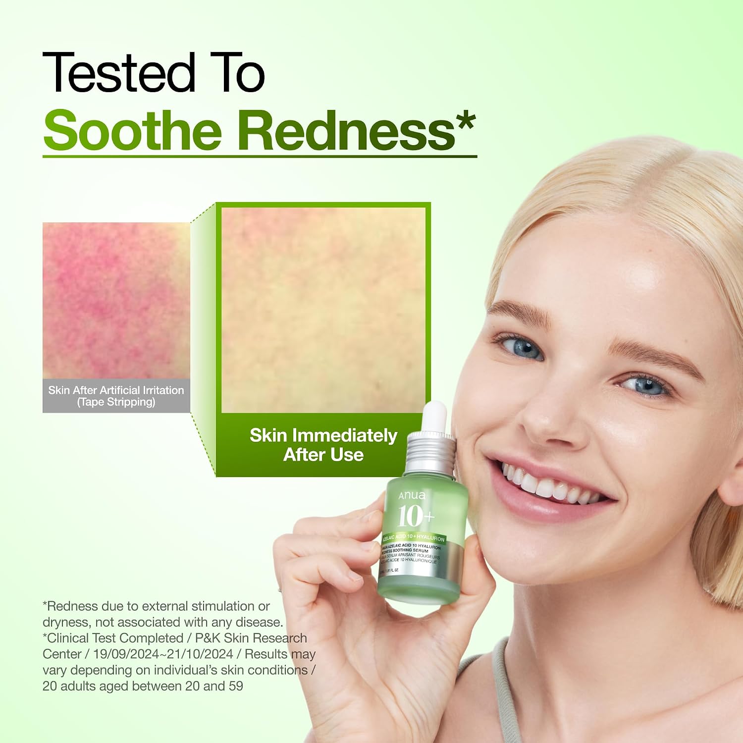 Thumbnail 5 de Anua Azelaic Acid 10 Serum for Redness 30ml