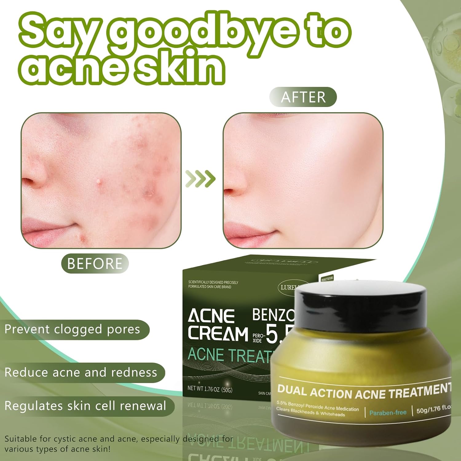 Detalle de TULAMORIY anti-acne gezichtscrème 50 g voor acnegevoelige huid