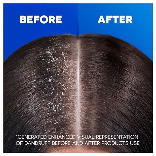 Detalle 2 de Head & Shoulders Citrus Fresh Anti Dandruff Shampoo for Greasy Hair 1L