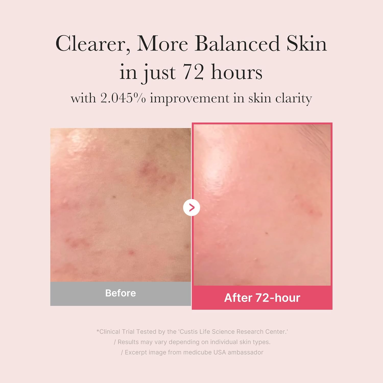 Detalle de medicube TXA+Niacinamide Glow Serum 1.01 fl.oz