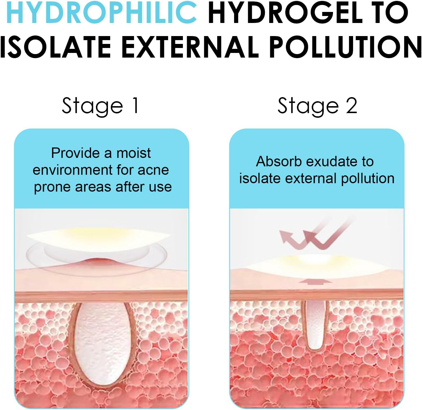 Detalle 1 de PimpleGuard 330-Piece Hydrocolloid Pimple Patches, Ultra-Thin Day & Night
