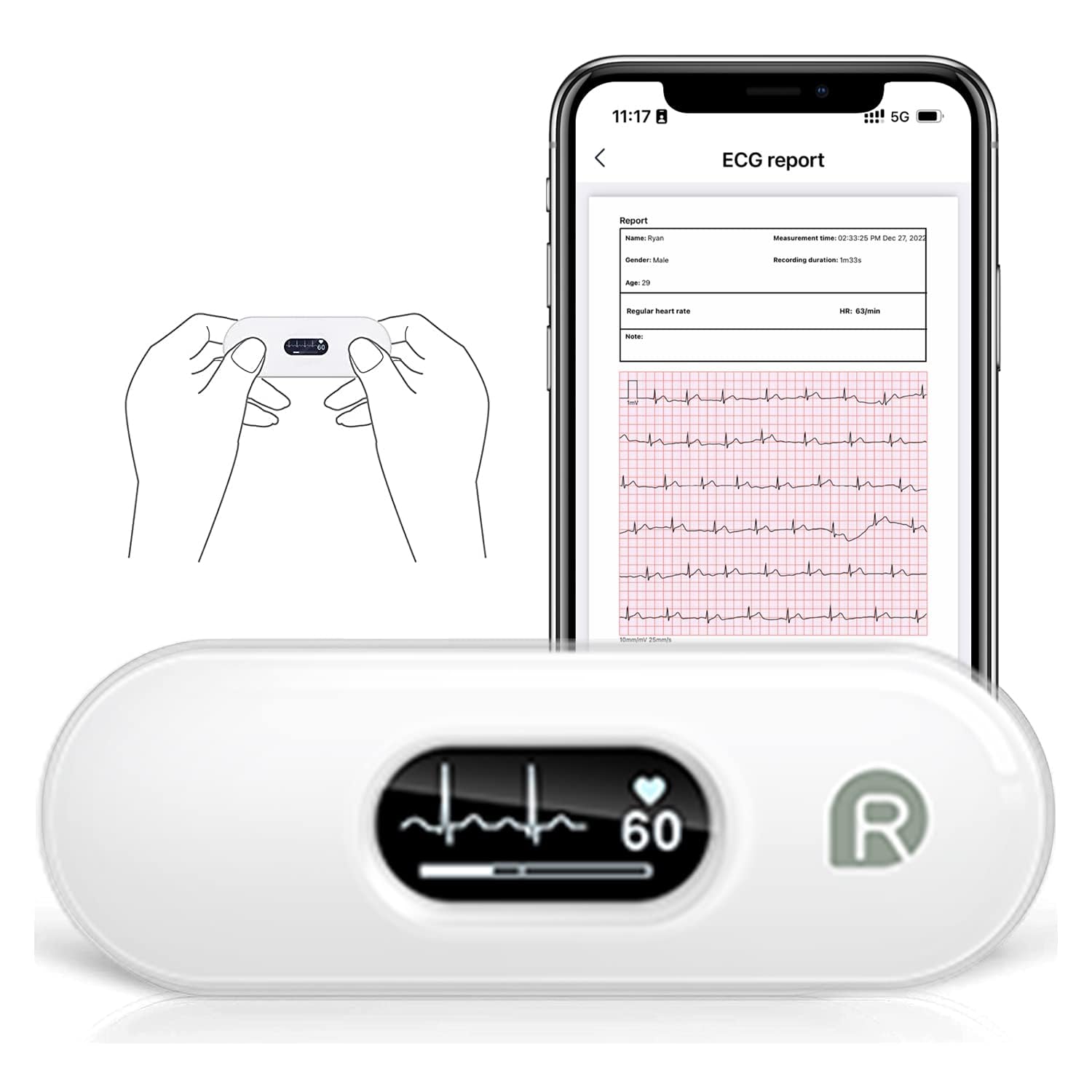 Detalle de CheckMe DuoEK-S home ECG monitor with Bluetooth and OLED screen